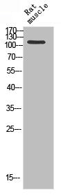 Western blot analysis of RAT-MUSLE using PARP1 antibody. Antibody was diluted at 1:1000. Secondary antibody was diluted at 1:20000