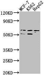 Western Blot Positive WB detected in: MCF-7 whole cell lysate, K562 whole cell lysate, HepG2 whole cell lysate All lanes: USP17L3 antibody at 1:1000 Secondary Goat polyclonal to rabbit IgG at 1/50000 dilution Predicted band size: 60 kDa Observed b...