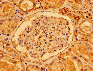 Immunohistochemistry of paraffin-embedded human kidney tissue using CSB-PA406800LA01HU at dilution of 1:100