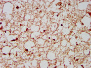 IHC image of CSB-PA407385LA01HU diluted at 1:200 and staining in paraffin-embedded human brain tissue performed on a Leica BondTM system. After dewaxing and hydration, antigen retrieval was mediated by high pressure in a citrate buffer (pH 6.0). S...
