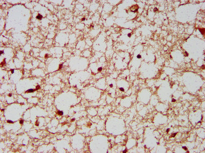 IHC image of CSB-PA407385LA01HU diluted at 1:200 and staining in paraffin-embedded human brain tissue performed on a Leica BondTM system. After dewaxing and hydration, antigen retrieval was mediated by high pressure in a citrate buffer (pH 6.0). S...