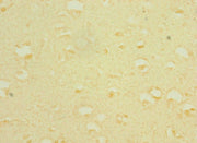 Immunohistochemistry of paraffin-embedded human brain tissue using CSB-PA408252ESR2HU at dilution of 1:100
