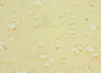 Immunohistochemistry of paraffin-embedded human brain tissue using CSB-PA408252ESR2HU at dilution of 1:100
