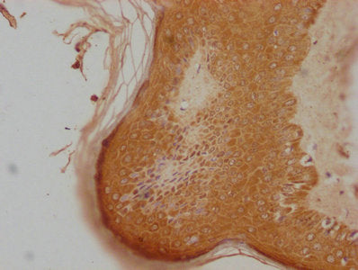 IHC image of CSB-PA408988LA01HU diluted at 1:100 and staining in paraffin-embedded human skin tissue performed on a Leica BondTM system. After dewaxing and hydration, antigen retrieval was mediated by high pressure in a citrate buffer (pH 6.0). Se...