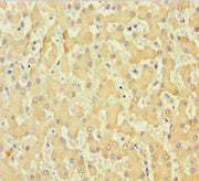 Immunohistochemistry of paraffin-embedded human liver tissue using CSB-PA409861LA01HU at dilution of 1:100