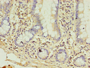 Immunohistochemistry of paraffin-embedded human small intestine tissue using CSB-PA409861YA01HU at dilution of 1:100