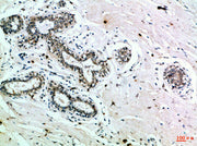 Immunohistochemical analysis of paraffin-embedded Human-breast, antibody was diluted at 1:100