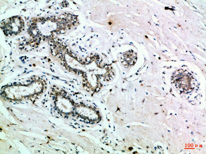 Immunohistochemical analysis of paraffin-embedded Human-breast, antibody was diluted at 1:100