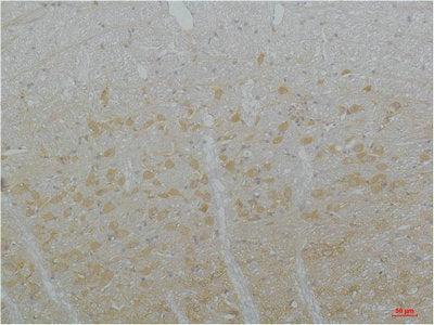 Immunohistochemical analysis of paraffin-embedded Rat Brain Tissue using Cav3.3Rabbit pAb diluted at 1:200.