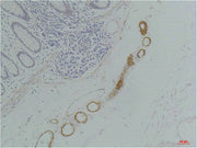 Immunohistochemical analysis of paraffin-embedded Human Colon Tissue using GRIK2(GluR6) Rabbit pAb diluted at 1:200.