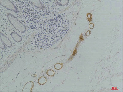 Immunohistochemical analysis of paraffin-embedded Human Colon Tissue using GRIK2(GluR6) Rabbit pAb diluted at 1:200.