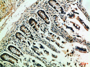 Immunohistochemical analysis of paraffin-embedded Human-colon, antibody was diluted at 1:100