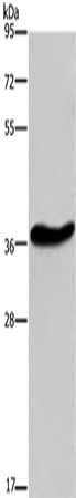 Gel: 8%SDS-PAGE, Lysate: 40 ug, Lane: Mouse brain tissue, Primary antibody: CSB-PA419324(GPR78 Antibody) at dilution 1/200, Secondary antibody: Goat anti rabbit IgG at 1/8000 dilution, Exposure time: 10 minutes