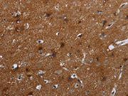 The image on the left is immunohistochemistry of paraffin-embedded Human brain tissue using CSB-PA420988(FMN2 Antibody) at dilution 1/20, on the right is treated with synthetic peptide. (Original magnification: ×200)