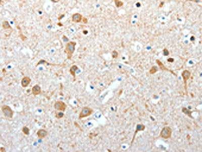 The image on the left is immunohistochemistry of paraffin-embedded Human brain tissue using CSB-PA425535(AKAP4 Antibody) at dilution 1/10, on the right is treated with fusion protein. (Original magnification: ×200)