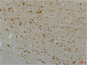 Immunohistochemical analysis of paraffin-embedded Rat Brain Tissue using Cav1.3Rabbit pAb diluted at 1:200.