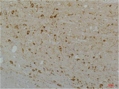 Immunohistochemical analysis of paraffin-embedded Rat Brain Tissue using Cav1.3Rabbit pAb diluted at 1:200.