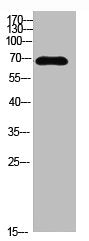 Western blot analysis of MCF7 SW480 MOUSE-LIVER mouse-lung MOUSE-KIDNEY lysate, antibody was diluted at 500. Secondary antibody was diluted at 1:20000