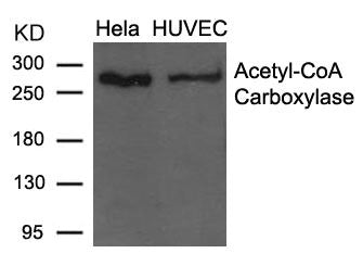 Western blot analysis of extracts from Hela and HUVEC cells using Acetyl-CoA Carboxylase (Ab-79) Antibody.