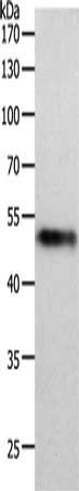 Gel: 10%SDS-PAGE, Lysate: 40 ug, Lane: Human lung tissue, Primary antibody: CSB-PA436622(MIDN Antibody) at dilution 1/1000, Secondary antibody: Goat anti rabbit IgG at 1/8000 dilution, Exposure time: 2 minutes