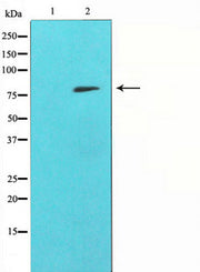 Western blot analysis on HepG2 cell lysate using MMP9 Antibody
