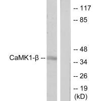 Western blot analysis of extracts from LOVO cells, treated with H2O2 (100uM, 30mins), using CaMK1-β antibody.
