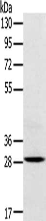 Gel: 8%SDS-PAGE, Lysate: 40 ug, Lane: Mouse brain tissue, Primary antibody: CSB-PA436852(TREM2 Antibody) at dilution 1/250, Secondary antibody: Goat anti rabbit IgG at 1/8000 dilution, Exposure time: 20 seconds