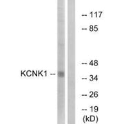 Western blot analysis of extracts from Jurkat cells, using KCNK1 antibody.