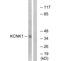 Western blot analysis of extracts from Jurkat cells, using KCNK1 antibody.