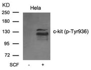 Western blot analysis of extracts from C6 cell untreated or treated with serum usingc-kit(phospho-Tyr936) Antibody.