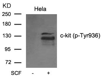 Western blot analysis of extracts from C6 cell untreated or treated with serum usingc-kit(phospho-Tyr936) Antibody.