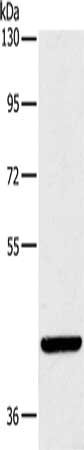 Gel: 8%SDS-PAGE, Lysate: 40 ug, Lane: Hela cells, Primary antibody: CSB-PA437456(LILRA1 Antibody) at dilution 1/250, Secondary antibody: Goat anti rabbit IgG at 1/8000 dilution, Exposure time: 1 minute