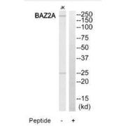 Western blot analysis of extracts from Jurkat cells, using BAZ2A antibody.