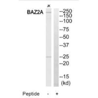 Western blot analysis of extracts from Jurkat cells, using BAZ2A antibody.