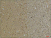 Immunohistochemical analysis of paraffin-embedded Rat BrainTissue using KCNK4 (TRAAK) Rabbit pAb diluted at 1:200.