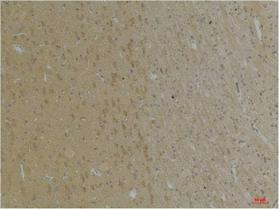 Immunohistochemical analysis of paraffin-embedded Rat BrainTissue using KCNK4 (TRAAK) Rabbit pAb diluted at 1:200.