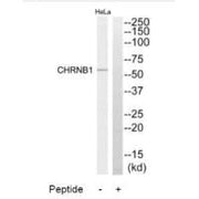 Western blot analysis of extracts from HeLa cells, using CHRNB1 antibody.