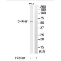 Western blot analysis of extracts from HeLa cells, using CHRNB1 antibody.
