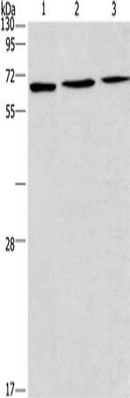 Gel: 12%SDS-PAGE, Lysate: 40 ug, Lane 1-3: 231 cells, LoVo cells, HepG2 cells, Primary antibody: CSB-PA437952(BIN3 Antibody) at dilution 1/275, Secondary antibody: Goat anti rabbit IgG at 1/8000 dilution, Exposure time: 2 minutes