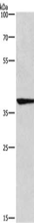 Gel: 8%SDS-PAGE, Lysate: 40 ug, Lane: Mouse heart tissue, Primary antibody: CSB-PA438294(IRF9 Antibody) at dilution 1/200, Secondary antibody: Goat anti rabbit IgG at 1/8000 dilution, Exposure time: 3 minutes