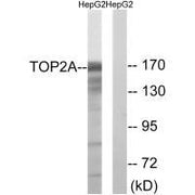 Western blot analysis of extracts from HepG2 cells, using TOP2A (Ab-1343) antibody.