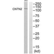 Western blot analysis of extracts from NIH-3T3 cells, using CNTN2 antibody.