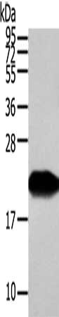 Gel: 12%SDS-PAGE, Lysate: 40 ug, Lane: Human fetal liver tissue, Primary antibody: CSB-PA438733(VPS25 Antibody) at dilution 1/350 dilution, Secondary antibody: Goat anti rabbit IgG at 1/8000 dilution, Exposure time: 30 seconds