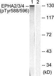 Western blot analysis of extracts from HepG2 cells using EPHA2/3/4 (Phospho-Tyr588/596) Antibody.The lane on the right is treated with the antigen-specific peptide.