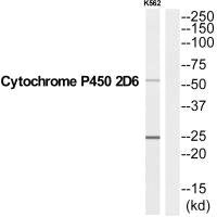 Western blot analysis of extracts from K562 cells, using CYP2D6 antibody.