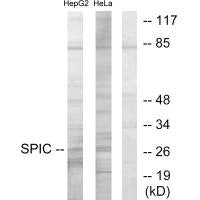 Western blot analysis of extracts from HepG2 cells and HeLa cells, using SPIC antibody.