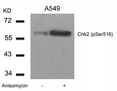 Western blot analysis of extracts from A549 cells untreated or treated with Anisomycin using Chk2(Phospho-Ser516) Antibody.