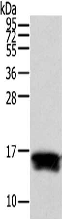 Gel: 12%SDS-PAGE,Lysate: 40 ug,,Primary antibody: CSB-PA440422(FABP1 Antibody) at dilution 1/200 dilution,Secondary antibody: Goat anti rabbit IgG at 1/8000 dilution,Exposure time: 20 seconds