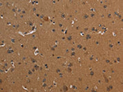 The image on the left is immunohistochemistry of paraffin-embedded Human brain tissue using CSB-PA440434(ICAM4 Antibody) at dilution 1/30, on the right is treated with fusion protein. (Original magnification: ×200)