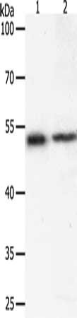 Gel: 10%SDS-PAGE, Lysate: 40 ug, Lane 1-2: Human liver cancer tissue, 293T cells, Primary antibody: CSB-PA440480(SOX1 Antibody) at dilution 1/400, Secondary antibody: Goat anti rabbit IgG at 1/8000 dilution, Exposure time: 20 seconds